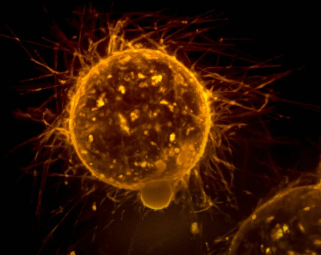 breast cancer symptoms stages and  treatment 